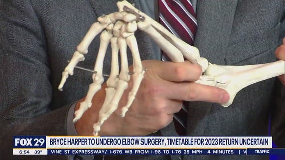 Health Watch: What surgery will Bryce Harper have on his elbow?