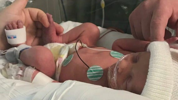 Thanksgiving Miracle: Preemie turns 5