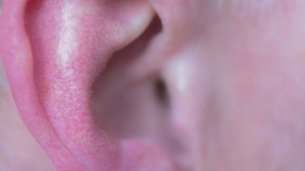 What is tinnitus and can it be cured?