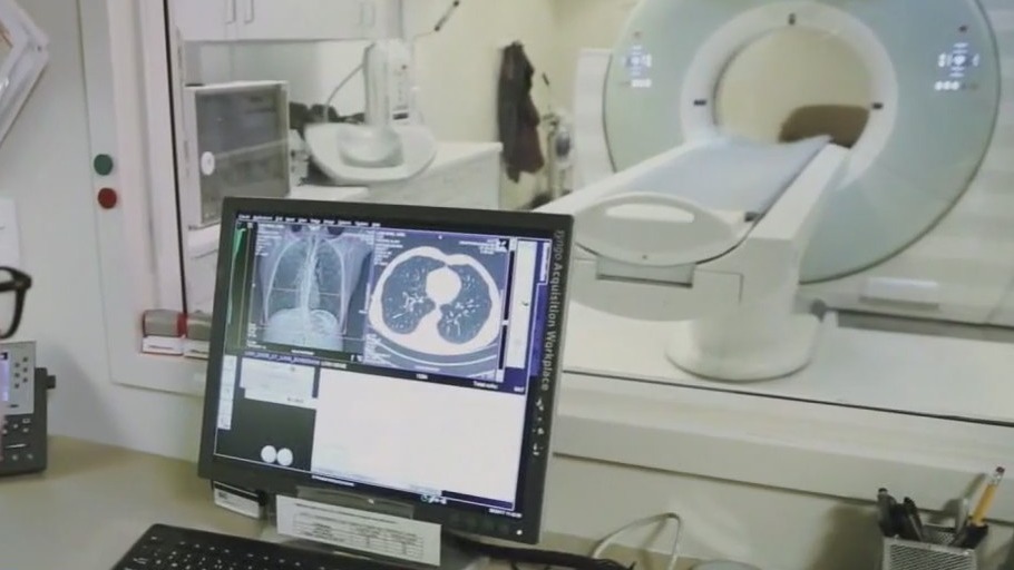 Lung Cancer Awareness Month: The detrimental effects of smoking