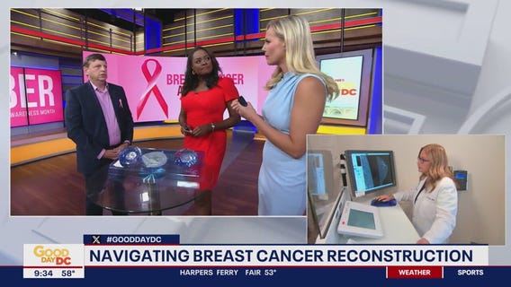 Navigating breast cancer reconstruction