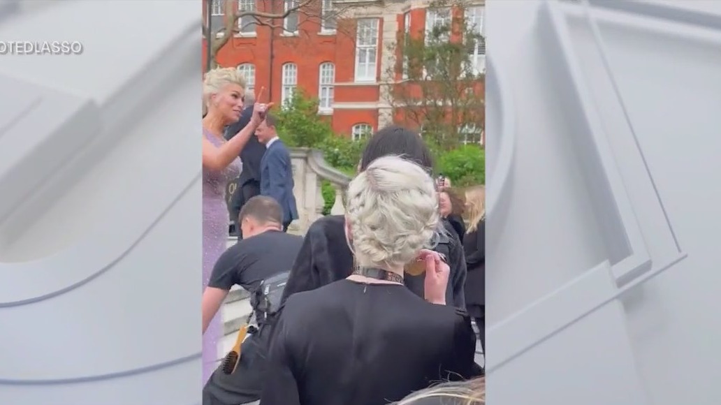 Hannah Waddingham scolds photographer over ?show? leg comment