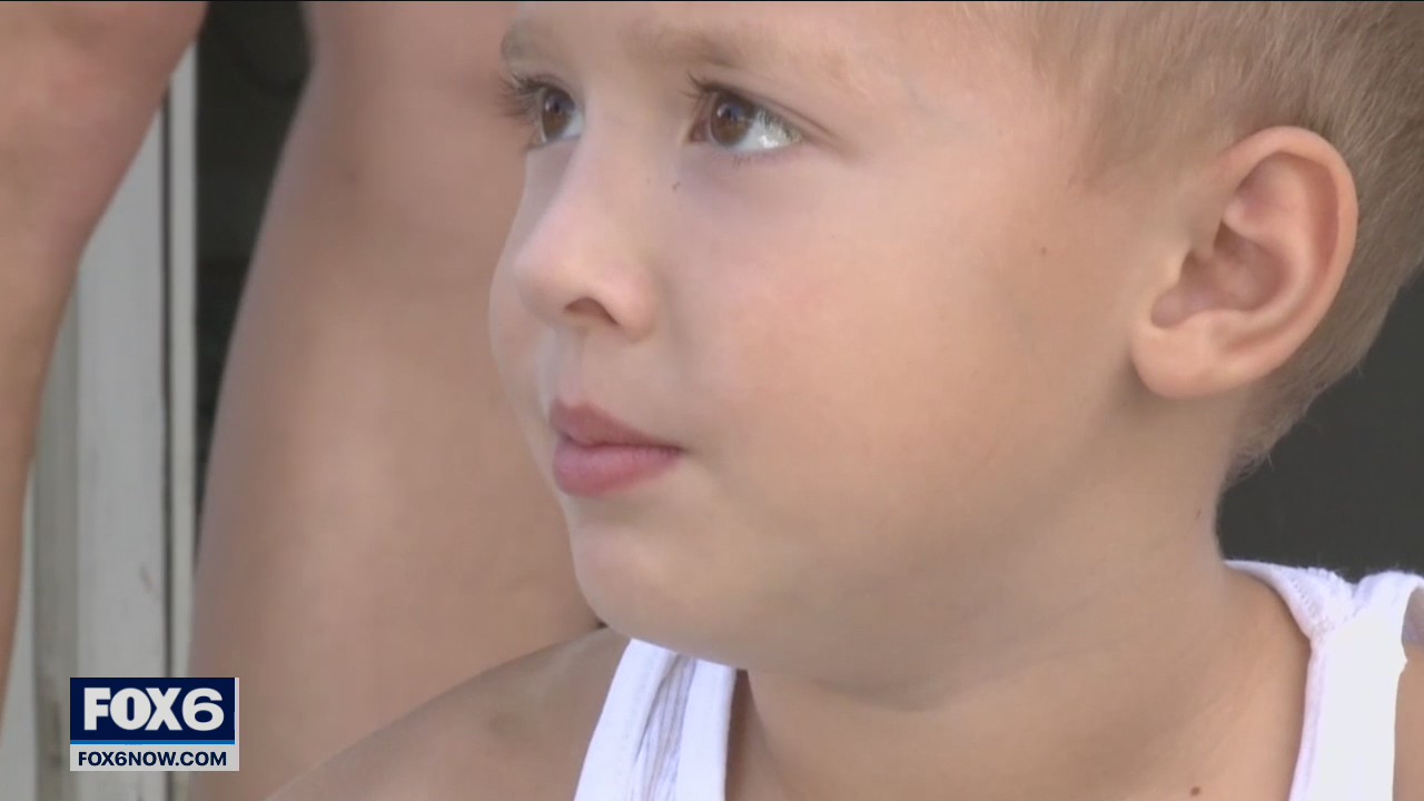 Cudahy boy faces long recovery