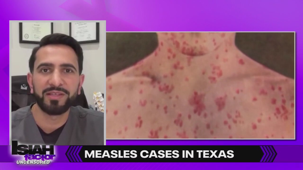Measles outbreak in Texas?