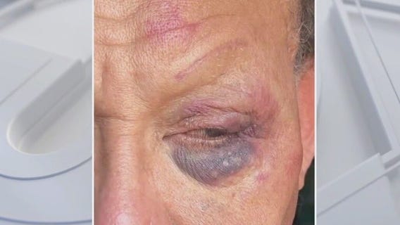 Transgender store owner attacked in MacArthur Park