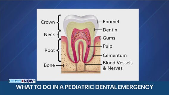 Pediatric dentists shares tips for handling holiday dental emergencies | ChicagoNOW