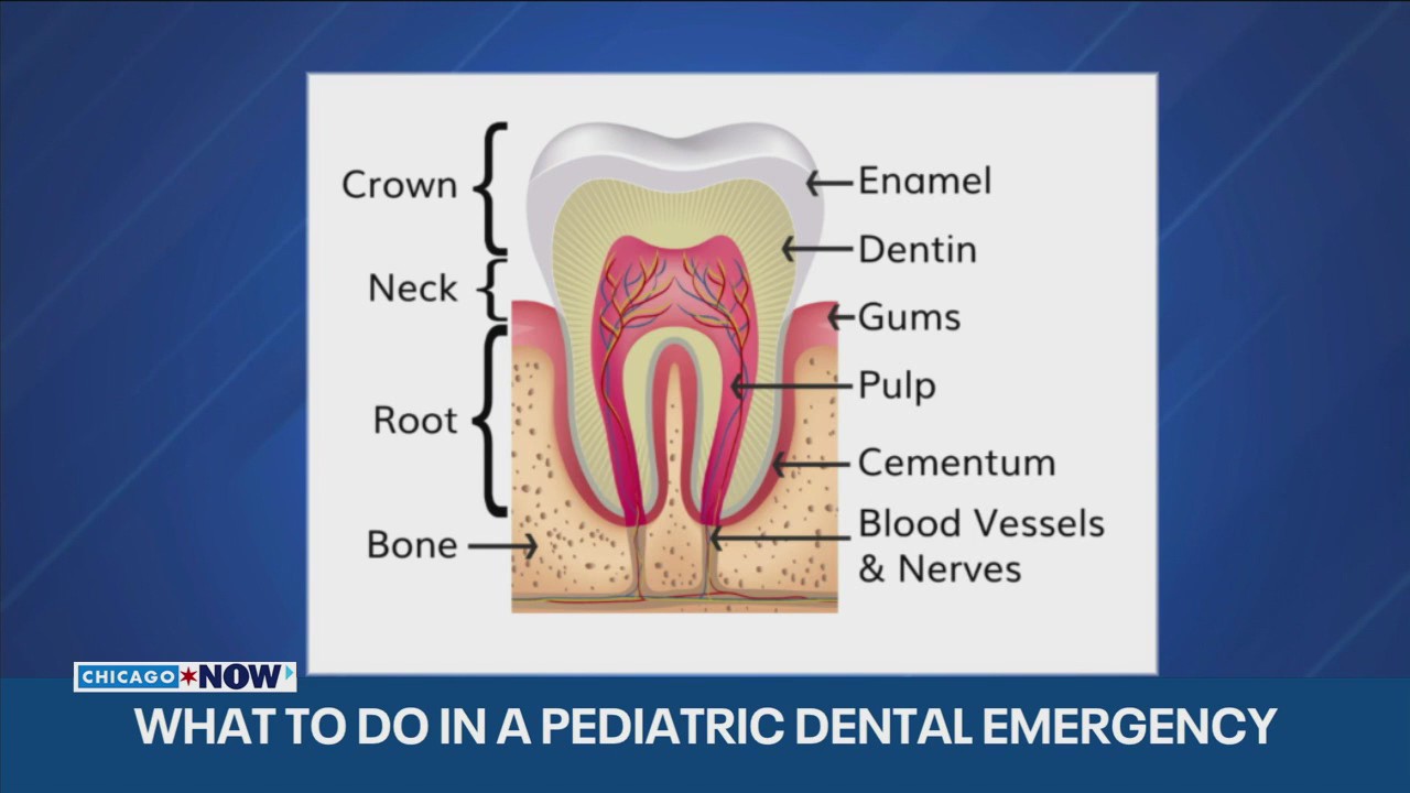Pediatric dentists shares tips for handling holiday dental emergencies | ChicagoNOW