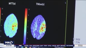 Brains may learn best when we're tired, Japan researchers say