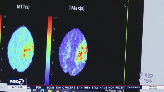 Brains may learn best when we're tired, Japan researchers say