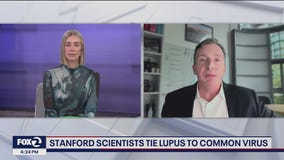 Stanford Scientists tie lupus to common virus