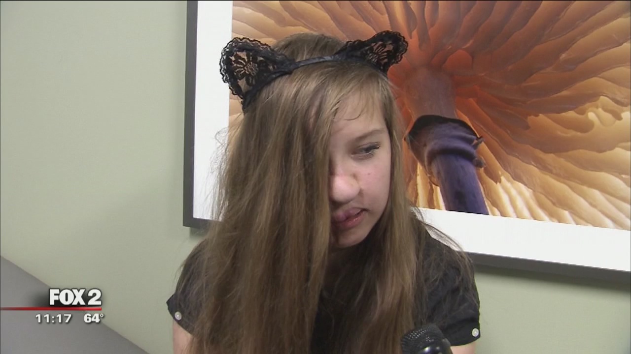 Girl mauled by raccoon as baby still making progress on 15th birthday