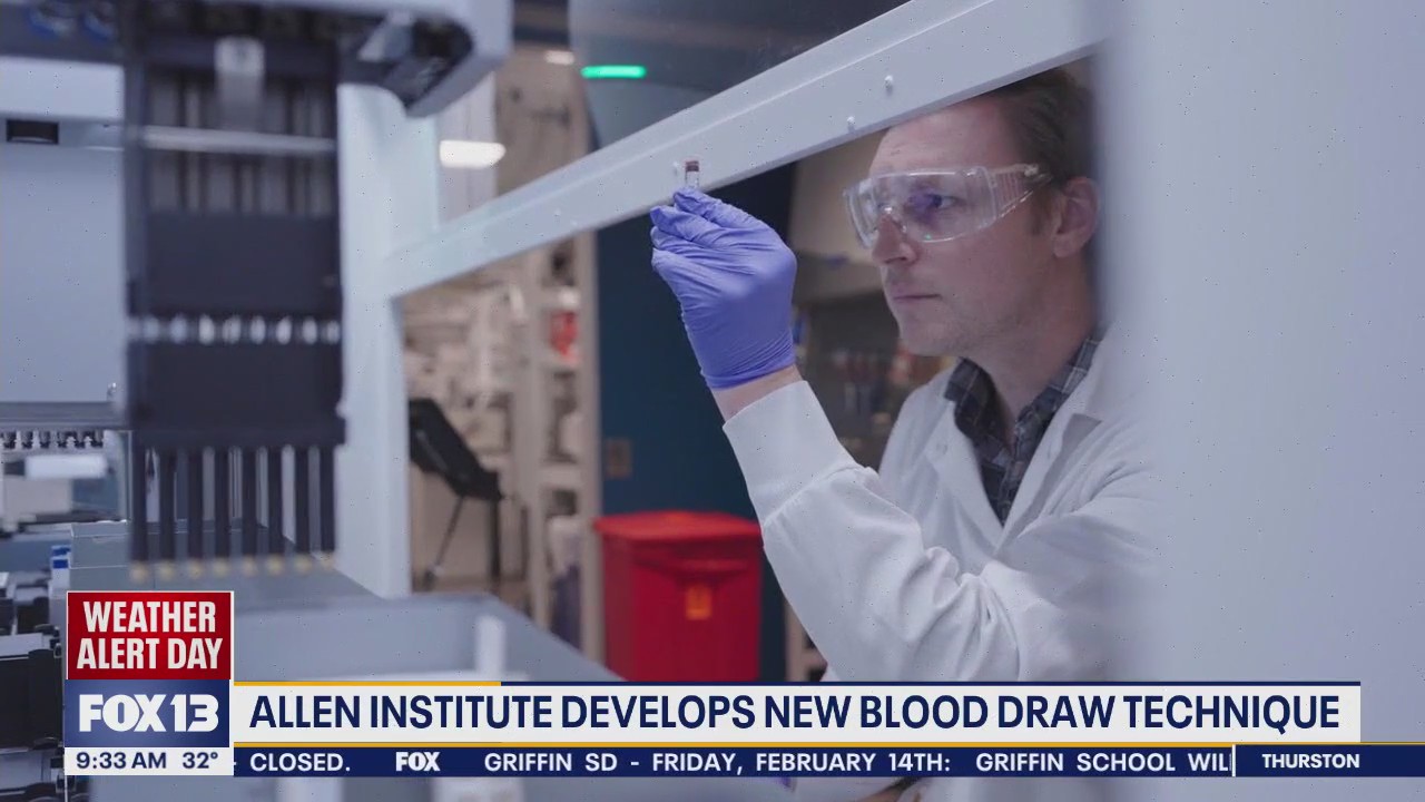 Allen Institute develops new blood draw technique