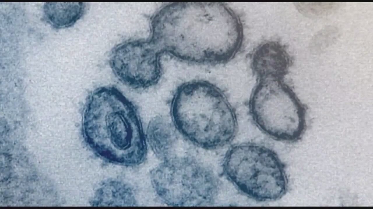 Doctor is in - Henry Ford Health doctor answers important questions about COVID-19