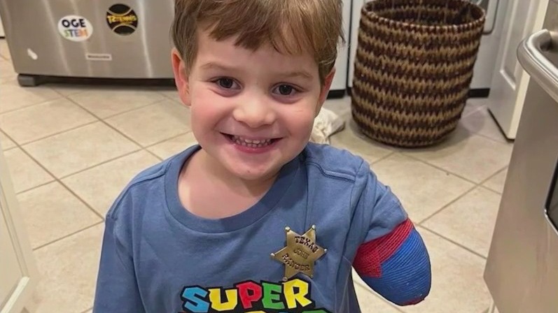 5-year-old undergoes high-tech arm amputation