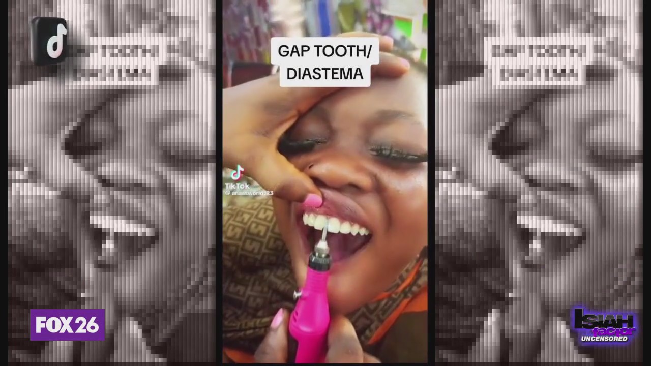 New trend: creating teeth gaps