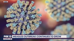 Measles outbreak continues to grow