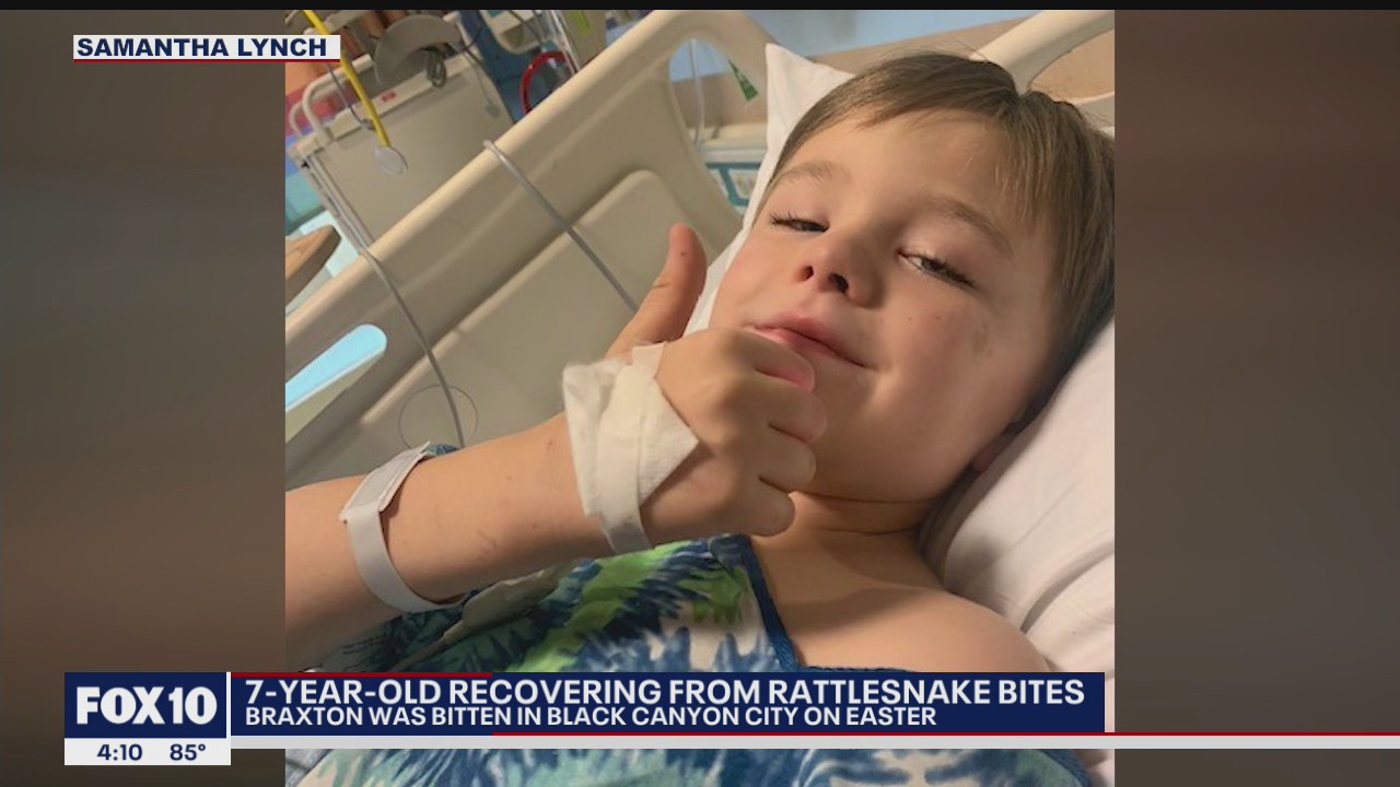 Boy recovering after rattlesnake bites on Easter