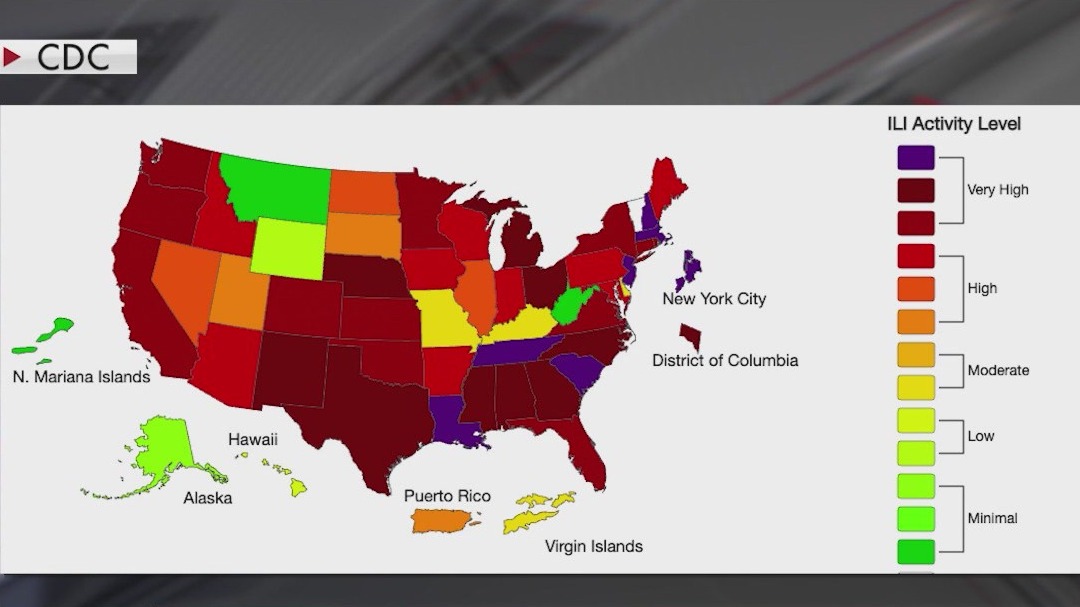 Flu: Cases spiking across the U.S.