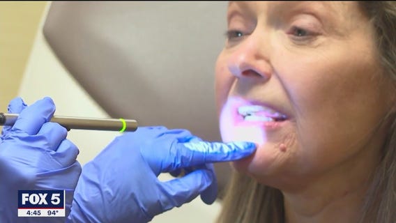 Oral cancer survivor relearns how to speak