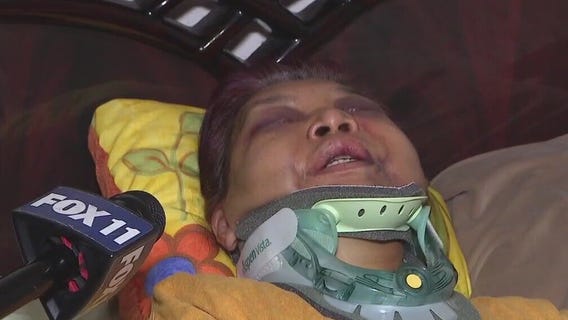 Elderly woman brutally beaten in East LA