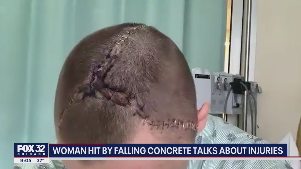 Chicago student hit by falling concrete talks about injuries
