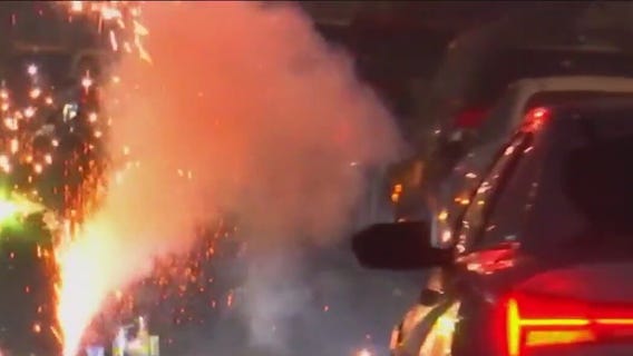 Boy watching fireworks struck by stray bullet in South LA