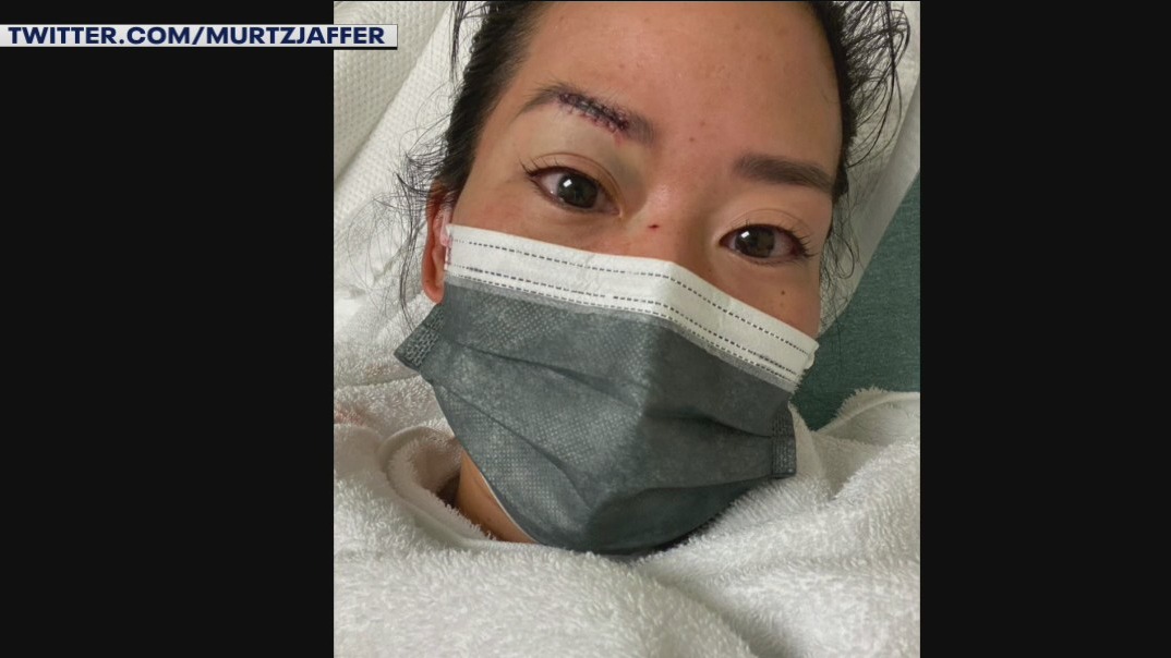Former ?Survivor? contestant Michelle Yi attacked by homeless woman in Santa Monica