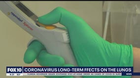 Phoenix doctor talks about the long-term effects of COVID-19 on lung function