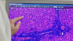 UCLA clinic hosts COVID-19 Moderna vaccine trial