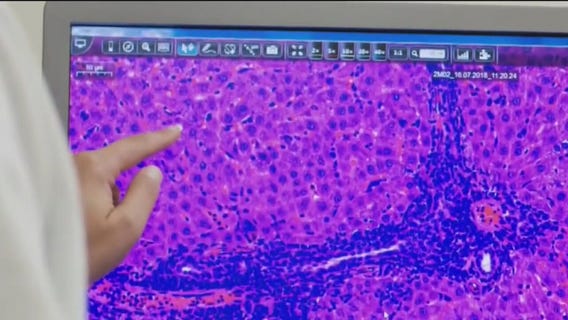 UCLA clinic hosts COVID-19 Moderna vaccine trial