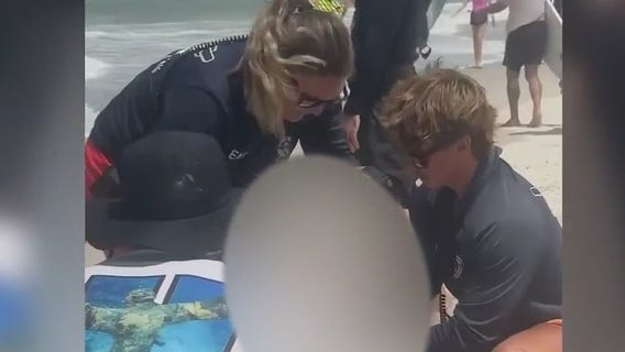 Man bitten by shark while surfing at New Smyrna Beach, officials say