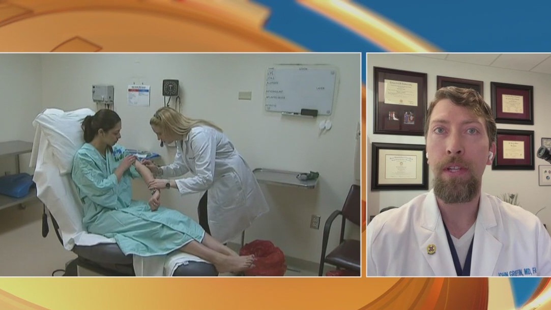 How to spot and treat skin cancer