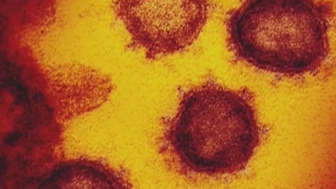 Slight rise in COVID-19 cases have leaders warning of a potential surge