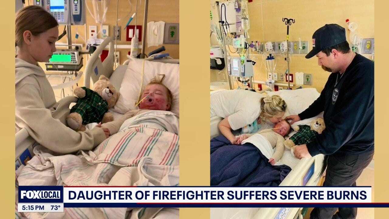 Firefighter’s 1-year-old daughter recovering after severe burns; firefighters rally to support family