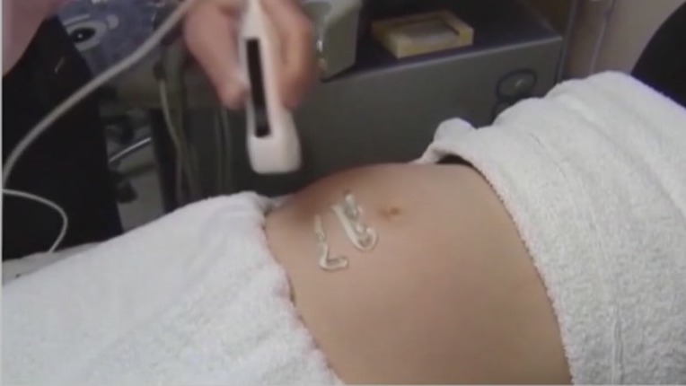 QR Codes for secret abortions handed out on college campuses