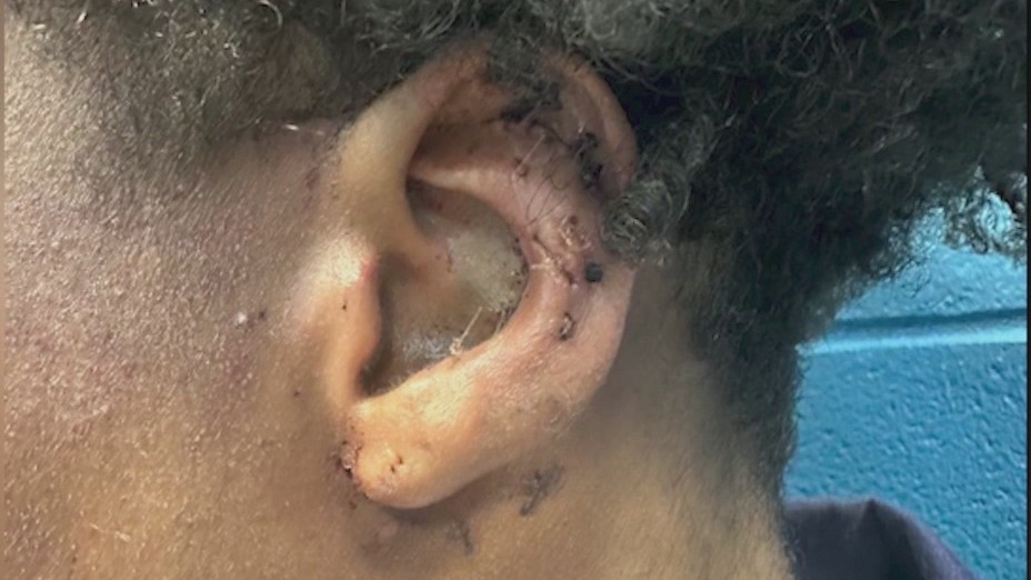 Fulton County Jail inmate stabbed multiple times