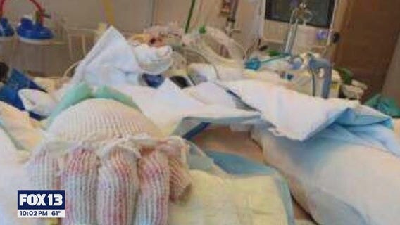 Community rallies around man burned in Tacoma apartment fire