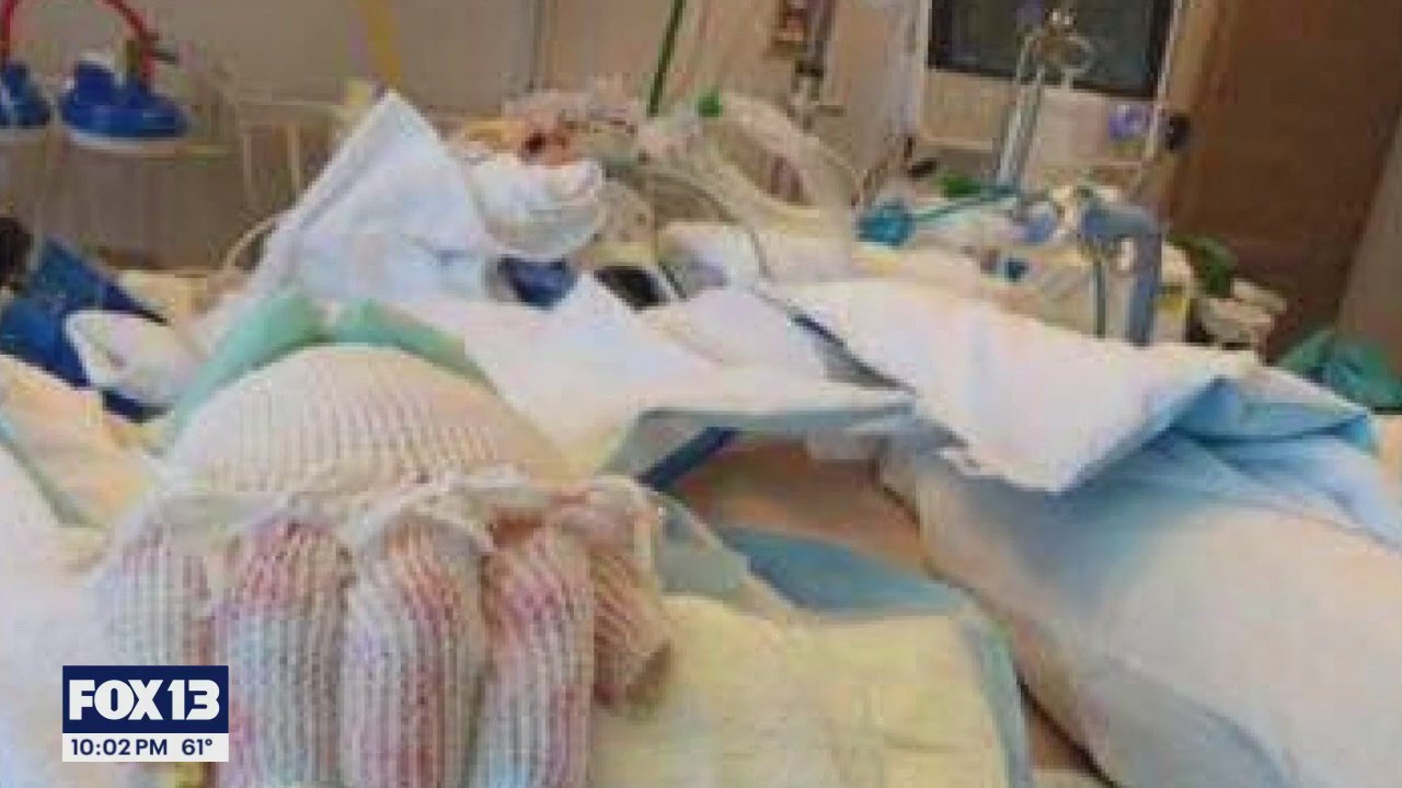 Community rallies around man burned in Tacoma apartment fire