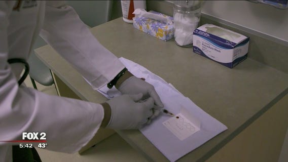 Researchers have developed a lab test that can help identify fibromyalgia in patients