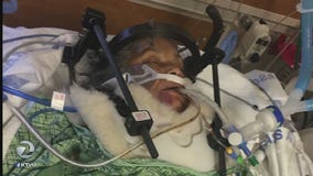 Woman left in grave condition after South Bay hit & run, police make arrest