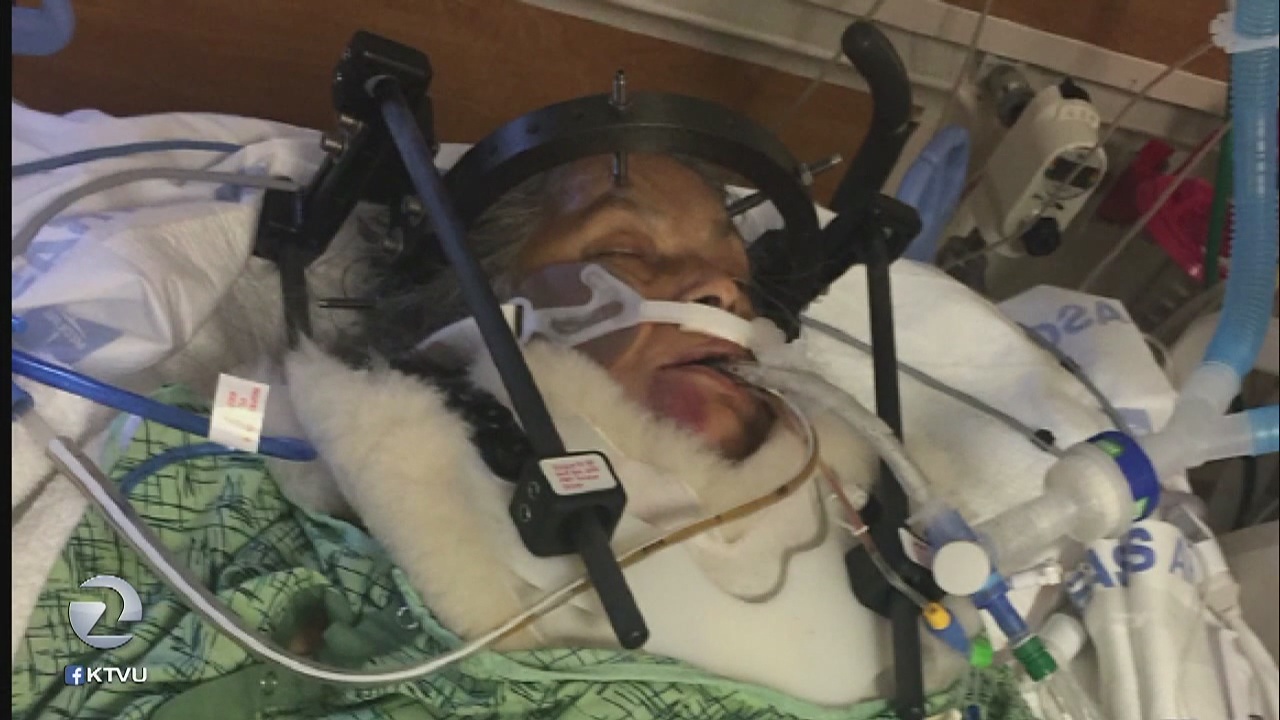 Woman left in grave condition after South Bay hit & run, police make arrest