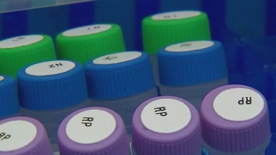 Measles cases reported in Will and Lake counties