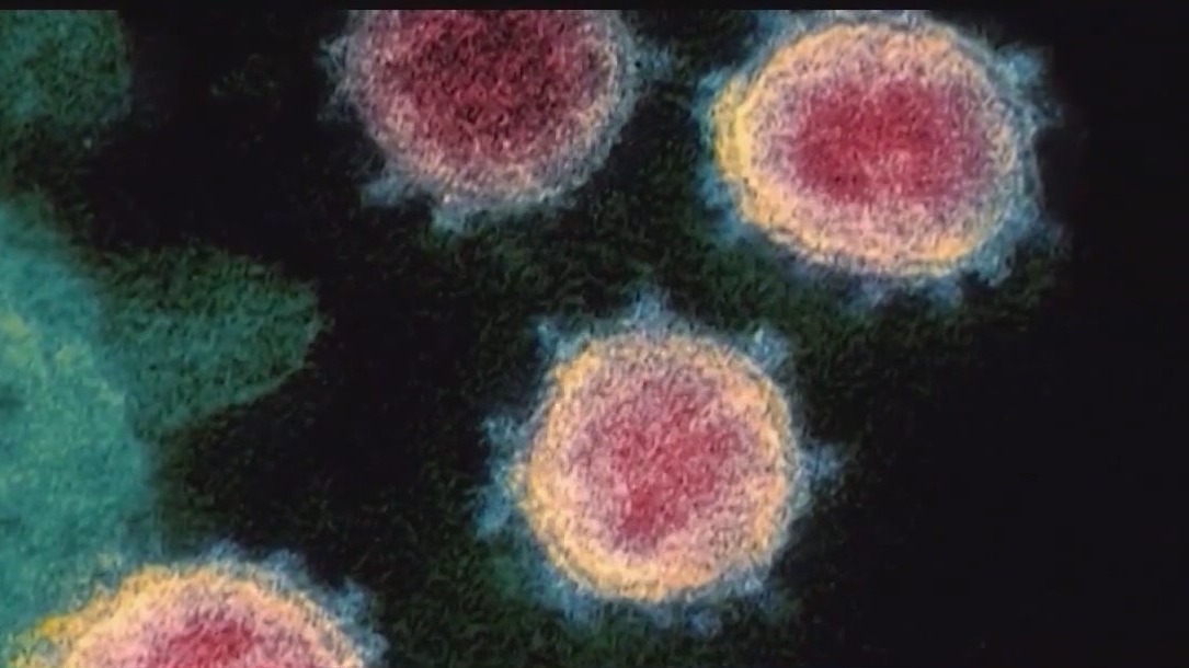 Scientists predict a worse pandemic