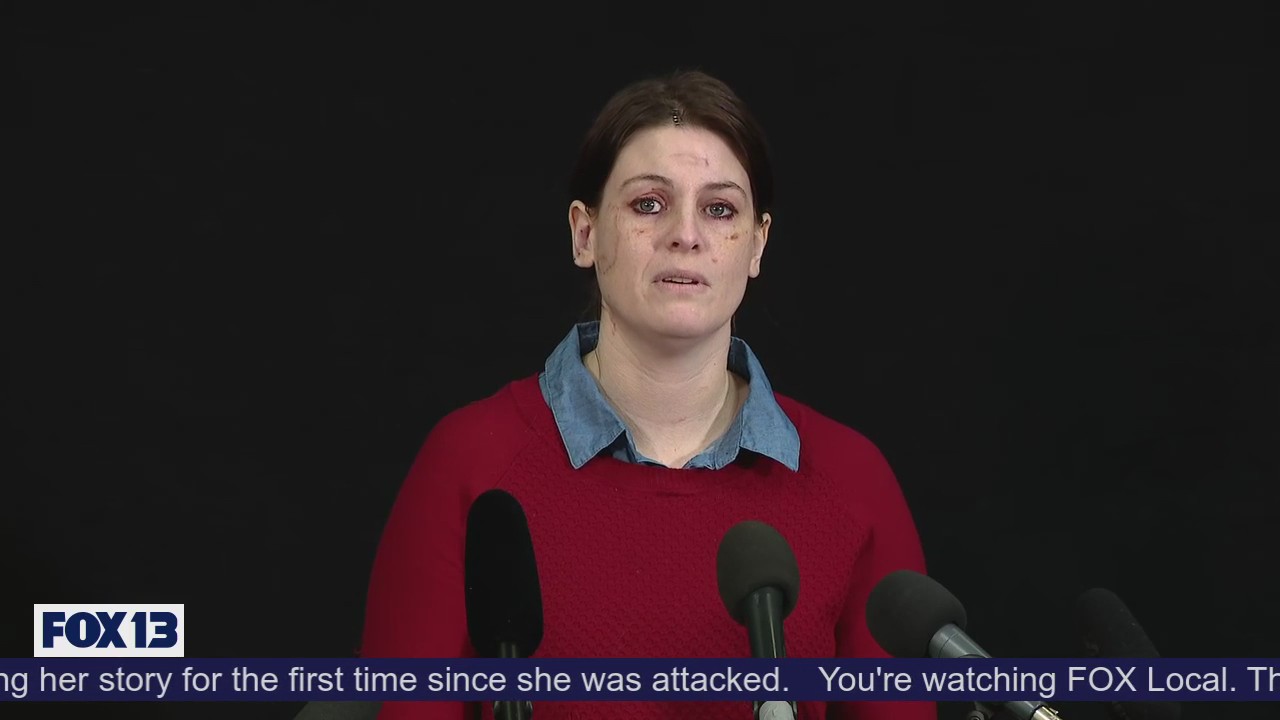 RAW: Point Defiance stabbing victim shares story of attack