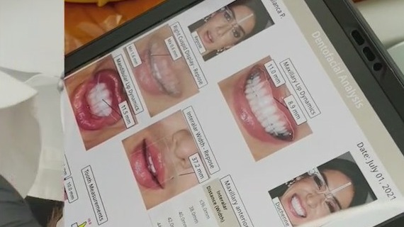 New smile makeover technology