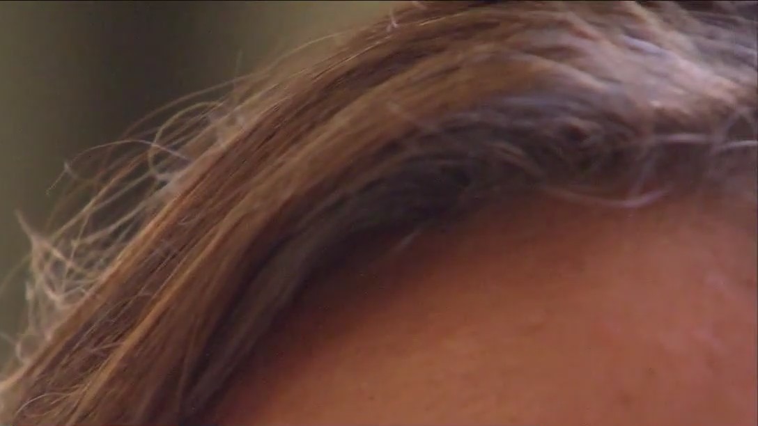 Tips for preventing hair loss for women