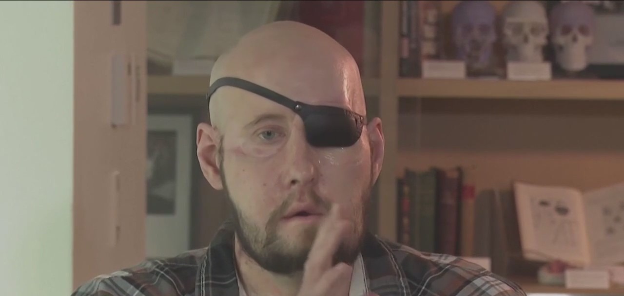 First human eye transplant