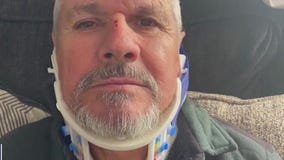 California Storms: Man injured after tree slams into him, his car