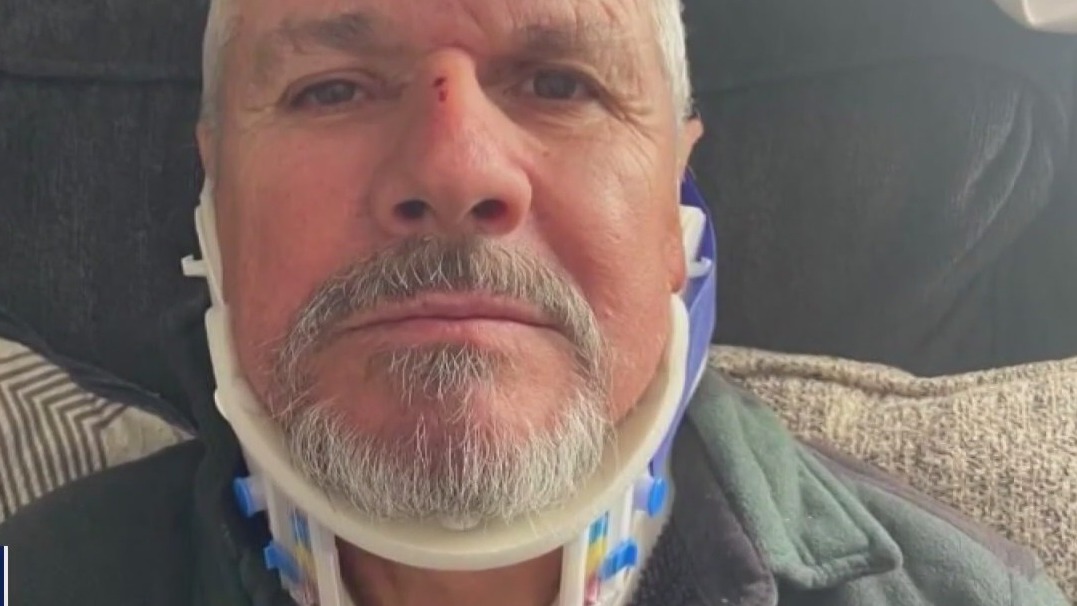 California Storms: Man injured after tree slams into him, his car