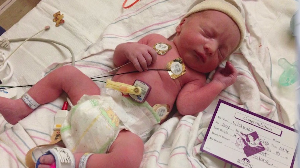 Scottsdale business runs fundraiser for NICU babies